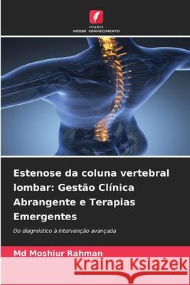 Estenose da coluna vertebral lombar: Gestão Clínica Abrangente e Terapias Emergentes Rahman, Md Moshiur 9786208467968 Edições Nosso Conhecimento - książka