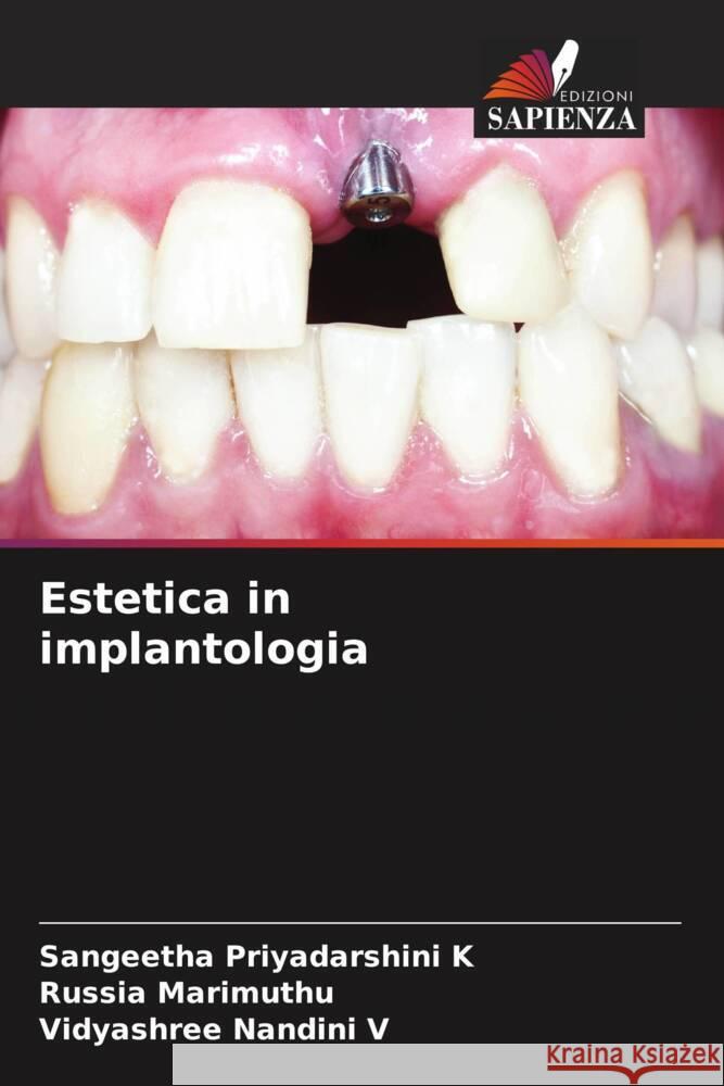 Estetica in implantologia K, Sangeetha Priyadarshini, Marimuthu, Russia, V, Vidyashree Nandini 9786206393429 Edizioni Sapienza - książka