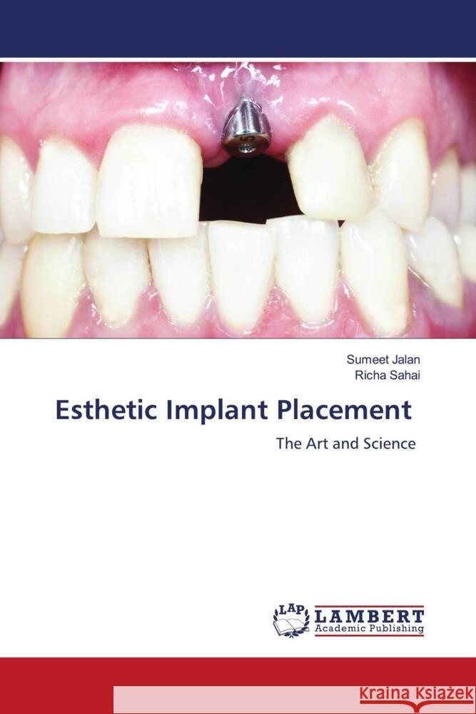 Esthetic Implant Placement Jalan, Sumeet, Sahai, Richa 9786204953113 LAP Lambert Academic Publishing - książka