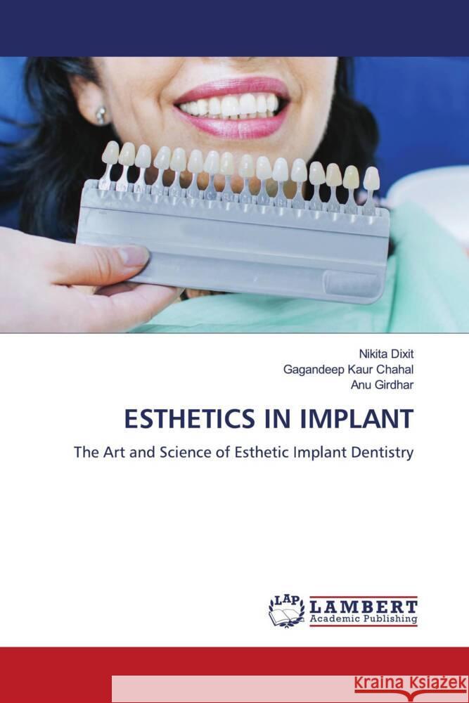 ESTHETICS IN IMPLANT Dixit, Nikita, Chahal, Gagandeep kaur, Girdhar, ANU 9786208427979 LAP Lambert Academic Publishing - książka