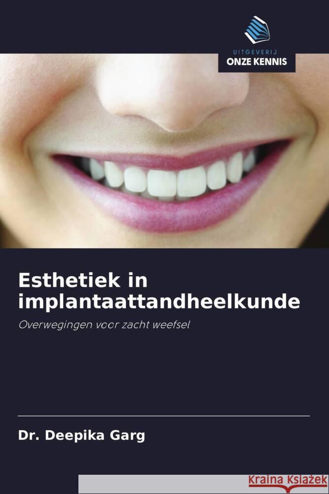 Esthetiek in implantaattandheelkunde Garg, Dr. Deepika 9786202939256 Uitgeverij Onze Kennis - książka