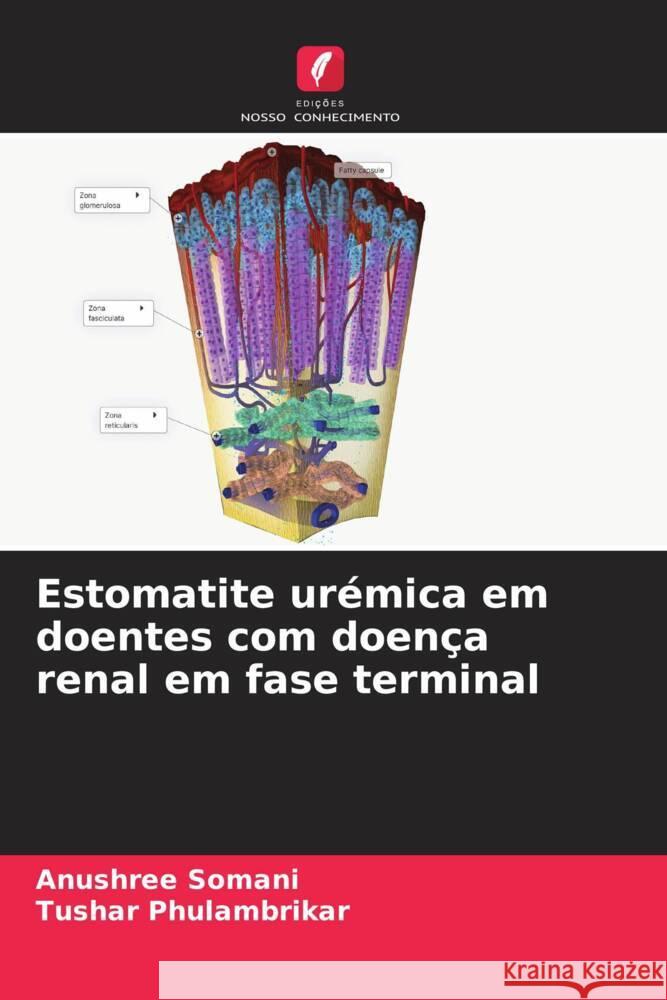 Estomatite ur?mica em doentes com doen?a renal em fase terminal Anushree Somani Tushar Phulambrikar 9786207336906 Edicoes Nosso Conhecimento - książka