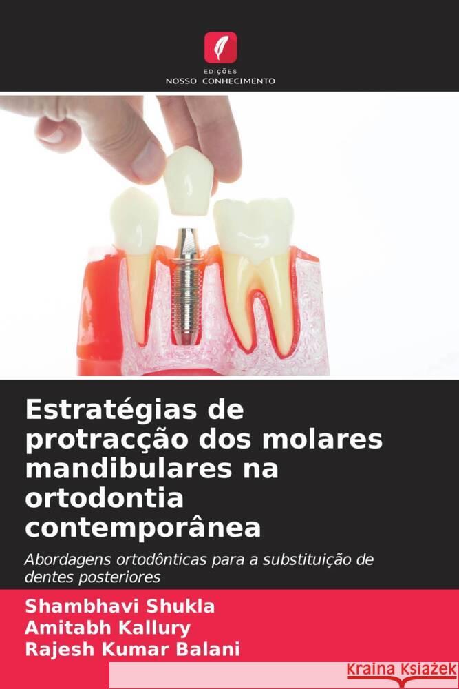 Estratégias de protracção dos molares mandibulares na ortodontia contemporânea Shukla, Shambhavi, Kallury, Amitabh, Kumar Balani, Rajesh 9786208254957 Edições Nosso Conhecimento - książka