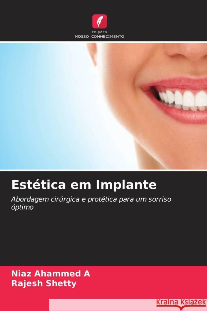 Estética em Implante Ahammed A, Niaz, Shetty, Rajesh 9786204448589 Edições Nosso Conhecimento - książka