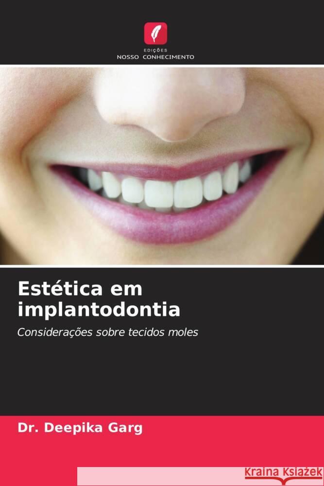 Estética em implantodontia Garg, Dr. Deepika 9786202939270 Edições Nosso Conhecimento - książka