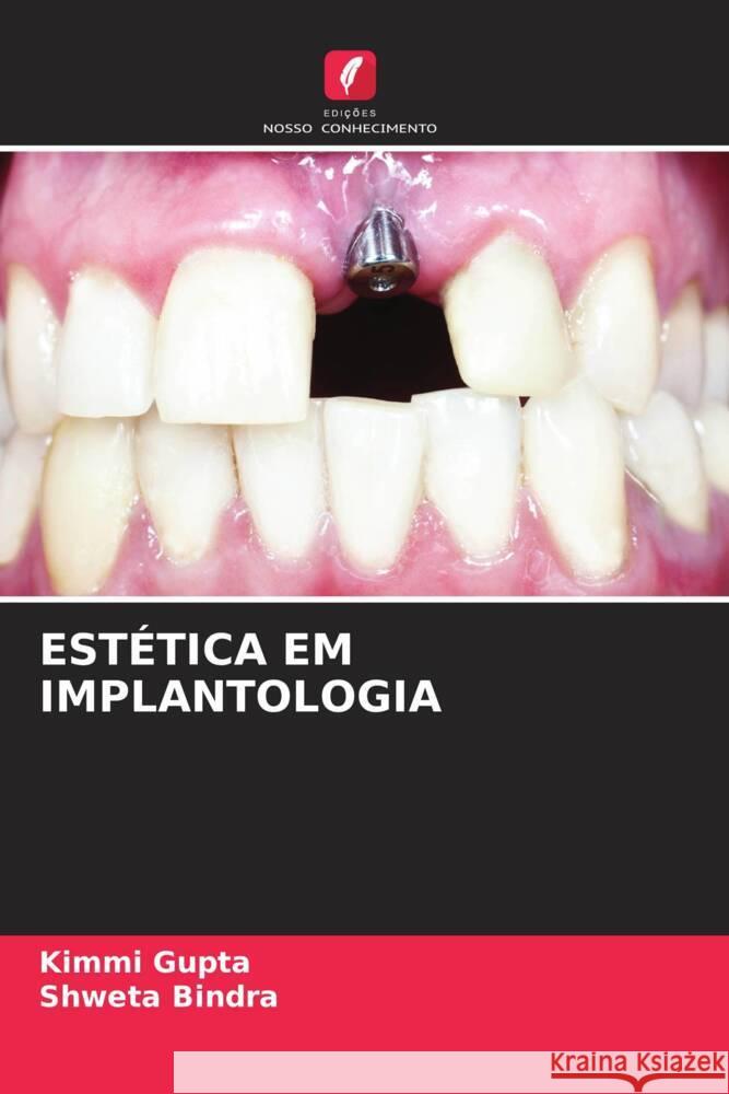 Est?tica Em Implantologia Kimmi Gupta Shweta Bindra 9786206670490 Edicoes Nosso Conhecimento - książka