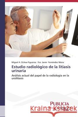 Estudio radiológico de la litiasis urinaria Ochoa Figueroa Miguel a. 9783639551372 Publicia - książka