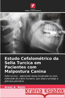 Estudo Cefalométrico da Sella Turcica em Pacientes com Malpostura Canina A. Najm, Areej 9786208817435 Edições Nosso Conhecimento - książka