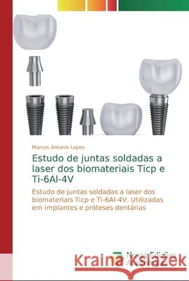 Estudo de juntas soldadas a laser dos biomateriais Ticp e Ti-6Al-4V Lopes, Marcos Antonio 9786139693429 Novas Edicioes Academicas - książka