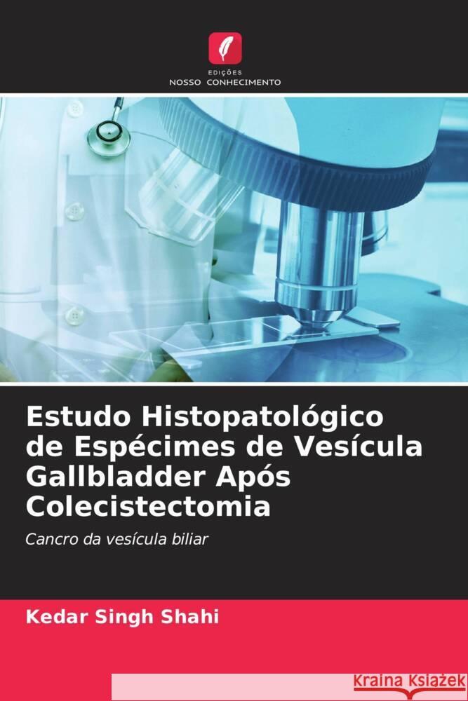 Estudo Histopatológico de Espécimes de Vesícula Gallbladder Após Colecistectomia Shahi, Kedar Singh, Shukla, Sanjeev Kumar 9786205088593 Edições Nosso Conhecimento - książka