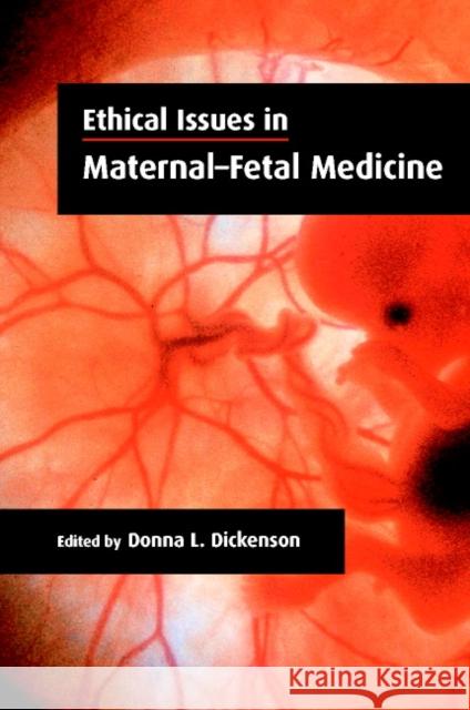 Ethical Issues in Maternal-Fetal Medicine Donna L. Dickenson Donna L. Dickenson 9780521664745 Cambridge University Press - książka