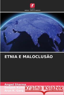 Etnia E Maloclusao Angad Sharma Deepak Kumar Gupta Arun K Garg 9786205606001 Edicoes Nosso Conhecimento - książka