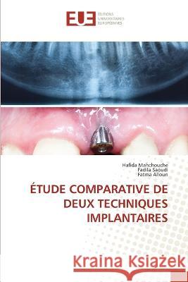 Etude Comparative de Deux Techniques Implantaires Hafida Mahchouche Fadila Saoudi Fatma Alloun 9786203455595 International Book Market Service Ltd - książka