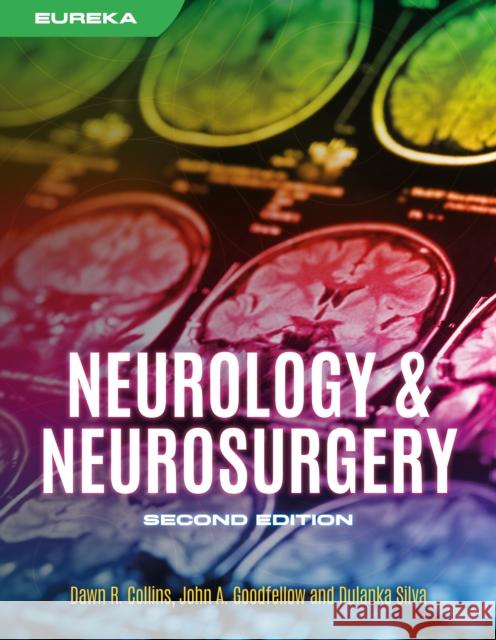 Eureka: Neurology & Neurosurgery, second edition Dulanka Silva 9781914961465 Scion Publishing Ltd - książka