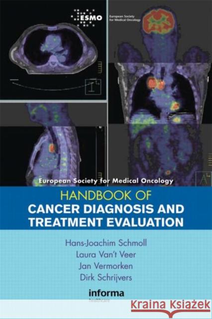 European Society for Medical Oncology Handbook of Cancer Diagnosis and Treatment Evaluation Schmoll, Hans-Joachim 9780415390866 Informa Healthcare - książka