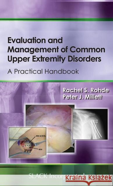 Evaluation and Management of Common Upper Extremity Disorders: A Practical Handbook Rohde, Rachel S. 9781556429491 Slack - książka