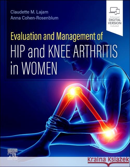Evaluation and Management of Hip and Knee Arthritis in Women Claudette M. Lajam Anna Cohen-Rosenblum 9780443105593 Elsevier - książka