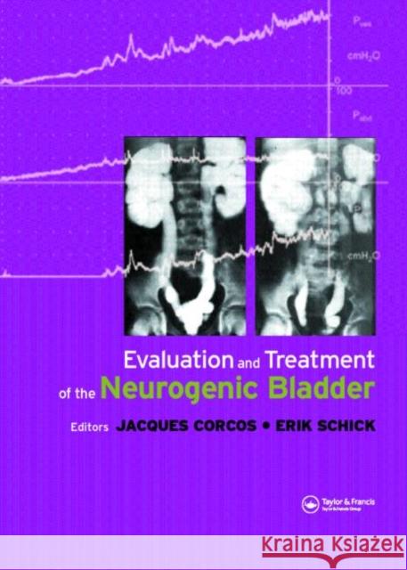 Evaluation and Treatment of the Neurogenic Bladder Jacques Corcos Eric Schick 9781841845579 Informa Healthcare - książka