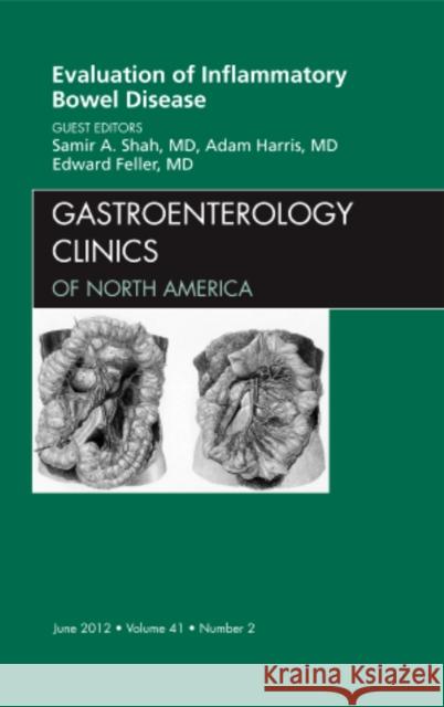 Evaluation of Inflammatory Bowel Disease, an Issue of Gastroenterology Clinics: Volume 41-2 Shah, Samir 9781455746279 The Clinics: Internal Medicine - książka