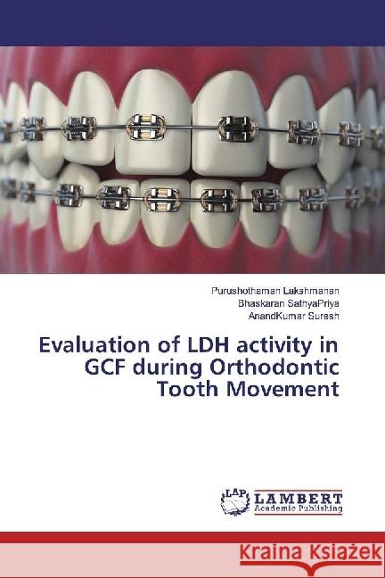 Evaluation of LDH activity in GCF during Orthodontic Tooth Movement Lakshmanan, Purushothaman; SathyaPriya, Bhaskaran; Suresh, AnandKumar 9786202075770 LAP Lambert Academic Publishing - książka