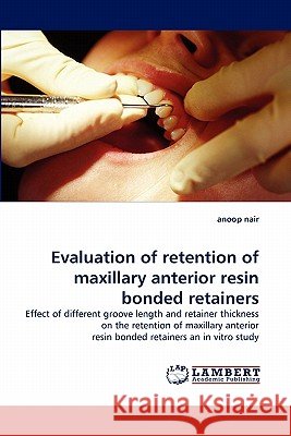 Evaluation of Retention of Maxillary Anterior Resin Bonded Retainers Anoop Nair 9783838383552 LAP Lambert Academic Publishing - książka