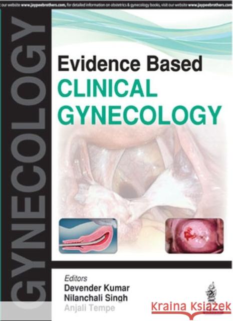 Evidence Based Clinical Gynecology Devender Kumar 9789386261786 Jaypee Brothers, Medical Publishers Pvt. Ltd. - książka