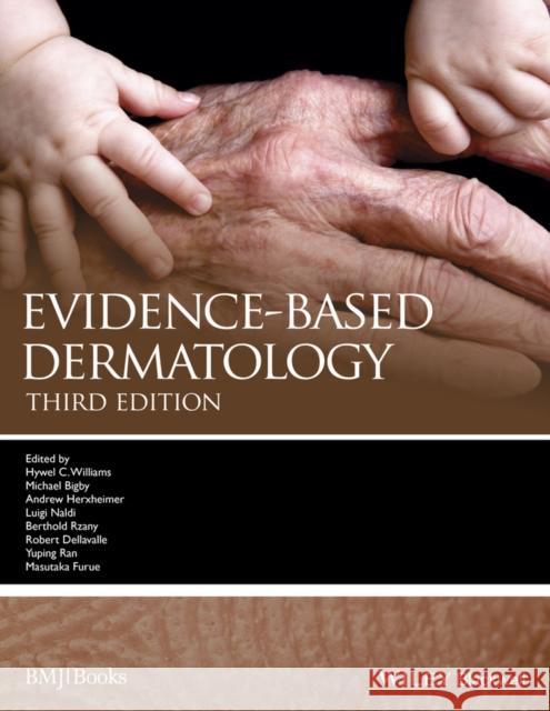 Evidence-Based Dermatology  9781118357675 John Wiley & Sons - książka