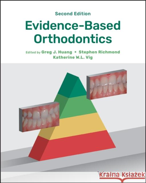 Evidence-Based Orthodontics Greg J. Huang Stephen Richmond Katherine W. L. Vig 9781119289913 Wiley-Blackwell - książka