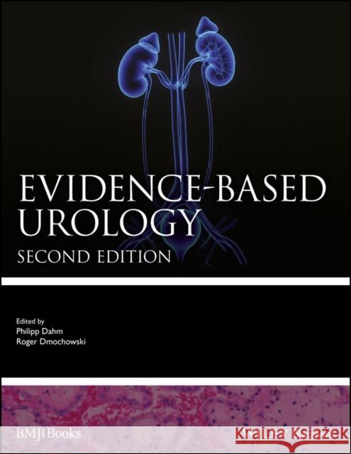 Evidence-Based Urology Dahm, Philipp 9781119129882 Wiley-Blackwell - książka