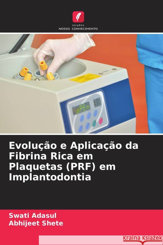 Evolução e Aplicação da Fibrina Rica em Plaquetas (PRF) em Implantodontia Adasul, Swati, Shete, Abhijeet 9786204758190 Edições Nosso Conhecimento - książka