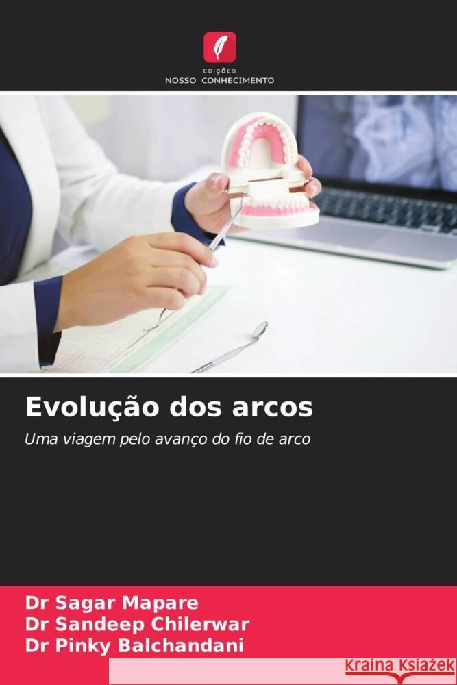 Evolu??o dos arcos Sagar Mapare Sandeep Chilerwar Pinky Balchandani 9786208115487 Edicoes Nosso Conhecimento - książka