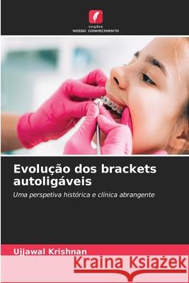 Evolução dos brackets autoligáveis Krishnan, Ujjawal 9786209031953 Edições Nosso Conhecimento - książka