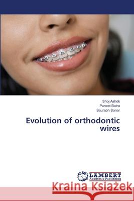 Evolution of orthodontic wires Ashok, Shoj; Batra, Puneet; Sonar, Saurabh 9786139581986 LAP Lambert Academic Publishing - książka