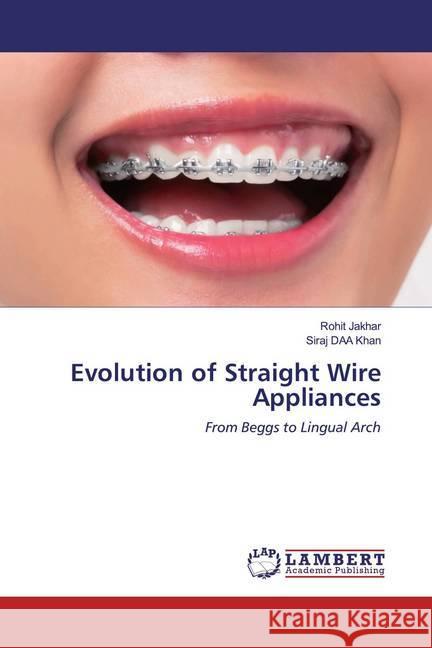 Evolution of Straight Wire Appliances : From Beggs to Lingual Arch Jakhar, Rohit; DAA Khan, Siraj 9786202522007 LAP Lambert Academic Publishing - książka
