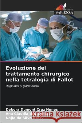 Evoluzione del trattamento chirurgico nella tetralogia di Fallot Dumont Cruz Nunes, Debora, dos Santos, Ana Cláudia, da Silva Brazv, Najla 9786206826521 Edizioni Sapienza - książka