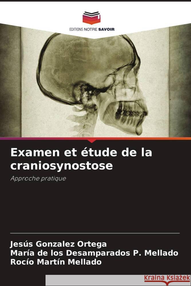 Examen et étude de la craniosynostose Ortega, Jesús Gonzalez, Mellado, María de los Desamparados P., Mellado, Rocío Martín 9786205421536 Editions Notre Savoir - książka