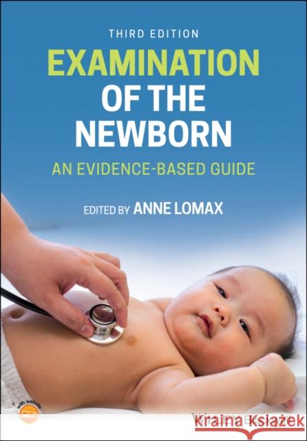 Examination of the Newborn: An Evidence-Based Guide Anne Lomax 9781119645597 Wiley-Blackwell - książka