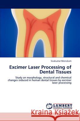 Excimer Laser Processing of Dental Tissues Sivakumar Manickam   9783847308232 LAP Lambert Academic Publishing AG & Co KG - książka