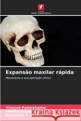 Expansão maxilar rápida Padmakumar, Vinayak, Hegde, Amitha, Shetty, Rajmohan Y. 9786209020056 Edições Nosso Conhecimento - książka