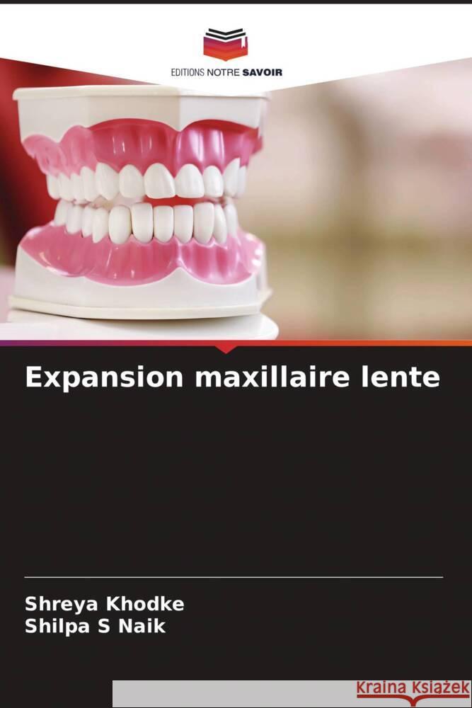 Expansion maxillaire lente Khodke, Shreya, Naik, Shilpa S 9786205247648 Editions Notre Savoir - książka