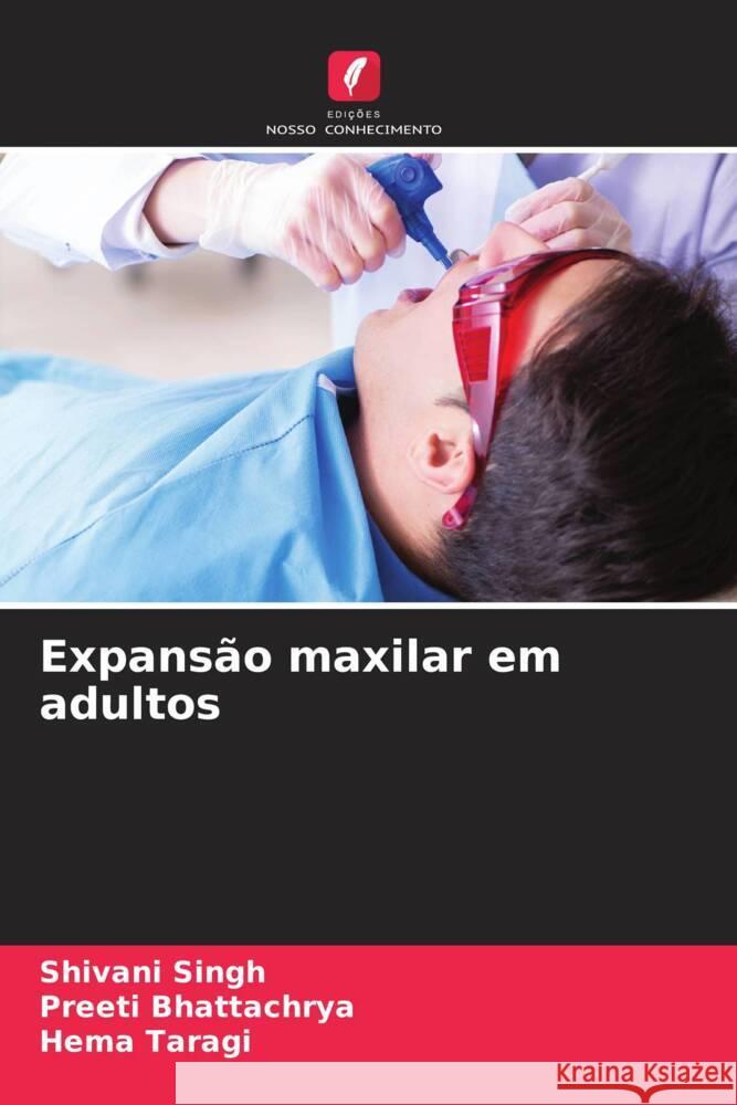 Expans?o maxilar em adultos Shivani Singh Preeti Bhattachrya Hema Taragi 9786206937289 Edicoes Nosso Conhecimento - książka