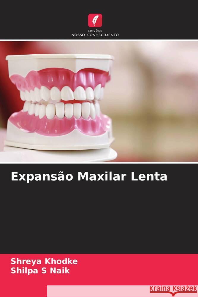 Expansão Maxilar Lenta Khodke, Shreya, Naik, Shilpa S 9786205247600 Edições Nosso Conhecimento - książka