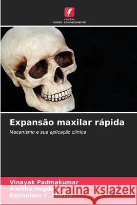 Expansão maxilar rápida Padmakumar, Vinayak, Hegde, Amitha, Shetty, Rajmohan Y. 9786209020056 Edições Nosso Conhecimento - książka