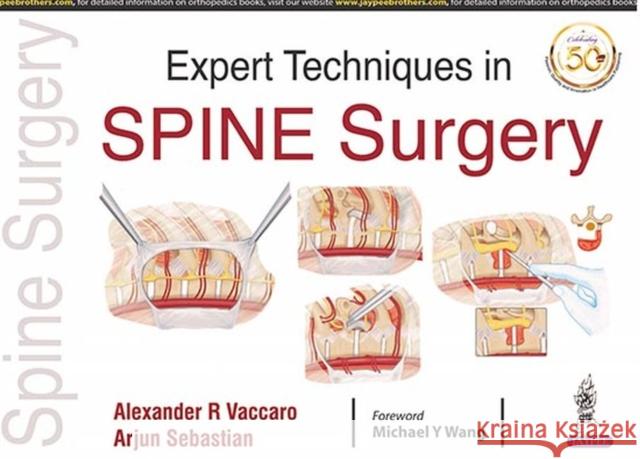 Expert Techniques in Spine Surgery R. Alexander Vaccaro 9789352709809 Jp Medical Ltd - książka