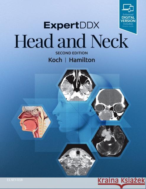 Expertddx: Head and Neck Koch, Bernadette L. 9780323554053 Elsevier - Health Sciences Division - książka