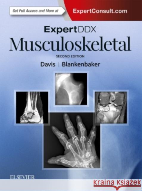 Expertddx: Musculoskeletal Davis, Kirkland W. 9780323524834 Elsevier - książka
