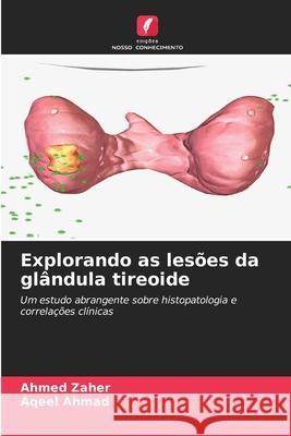 Explorando as les?es da gl?ndula tireoide Ahmed Zaher Aqeel Ahmad 9786207681303 Edicoes Nosso Conhecimento - książka