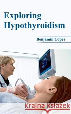 Exploring Hypothyroidism Benjamin Copes 9781632421913 Foster Academics - książka