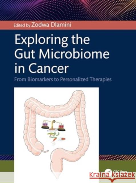 Exploring the Gut Microbiome in Cancer: From Biomarkers to Personalized Therapies Zodwa Dlamini 9781032706429 CRC Press - książka