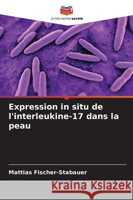 Expression in situ de l'interleukine-17 dans la peau Fischer-Stabauer, Mattias 9786208901226 Editions Notre Savoir - książka